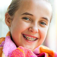 Early Orthodontics, Childrens Dentist, North Delta